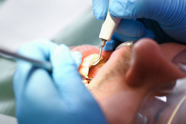 Best Emergency Gum Treatment in Wd, AR