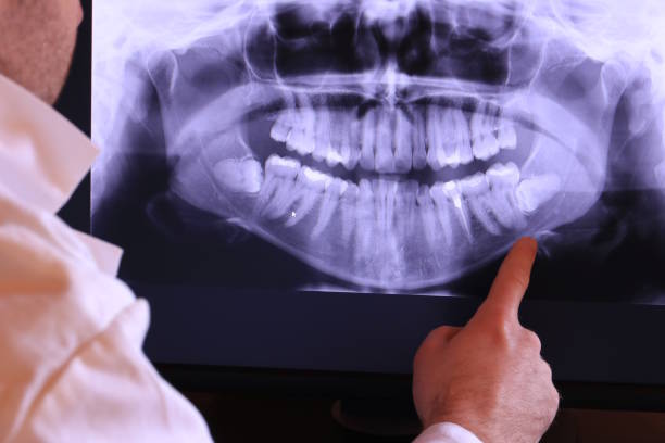 Best Emergency Wisdom Teeth Removal in Wd, AR