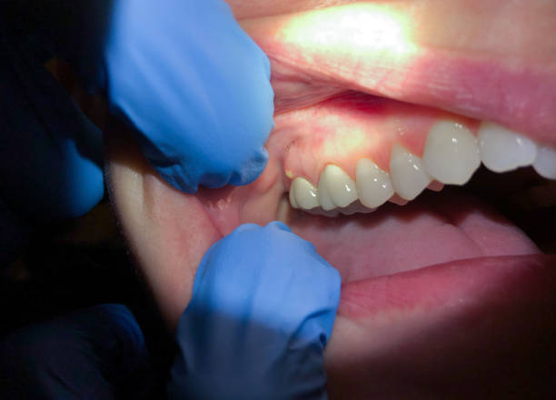 Best Same-Day Emergency Dental Services in Wd, AR