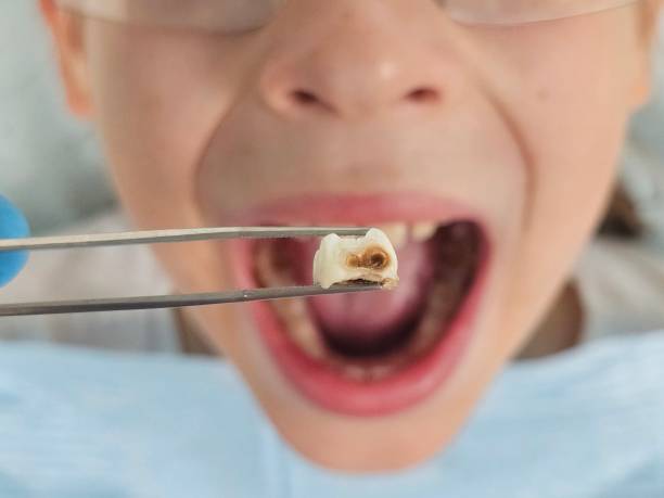 Best Emergency Gum Treatment in Wd, AR